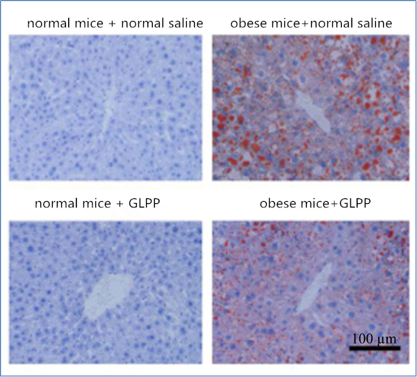 Flag 1 A month later, fat distribution (red part) in liver tissue of obese mice and normal mice was compared.