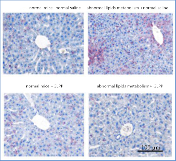 flag2 A month later, fat distribution (red part) in liver tissue of obese mice and normal mice was compared.