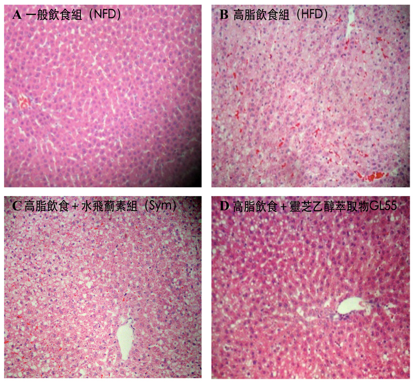 Fig 2 sections for liver tissue of different rats group