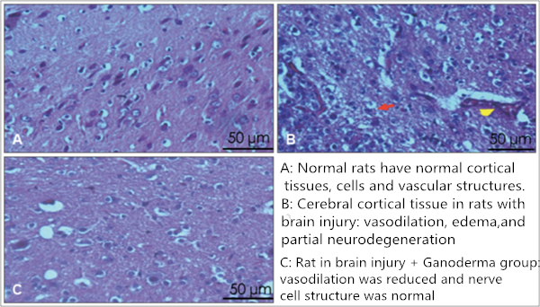 Ganoderma Lucidum Polysaccharide Accelerates Recovery of Brain Injury